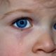 What Causes Crossed Eyes?